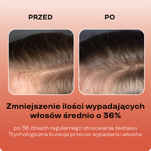 Stymulujący peeling przeciw wypadaniu włosów, 3% kwasu szikimowego, 3% kwasu glikolowego, adenozyna, fermentowany ekstrakt z żeń-szenia