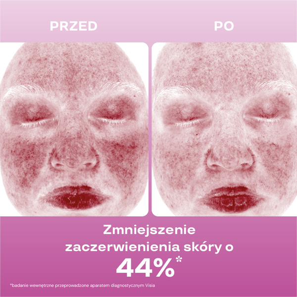 Zestaw: Napięcie i ukojenie